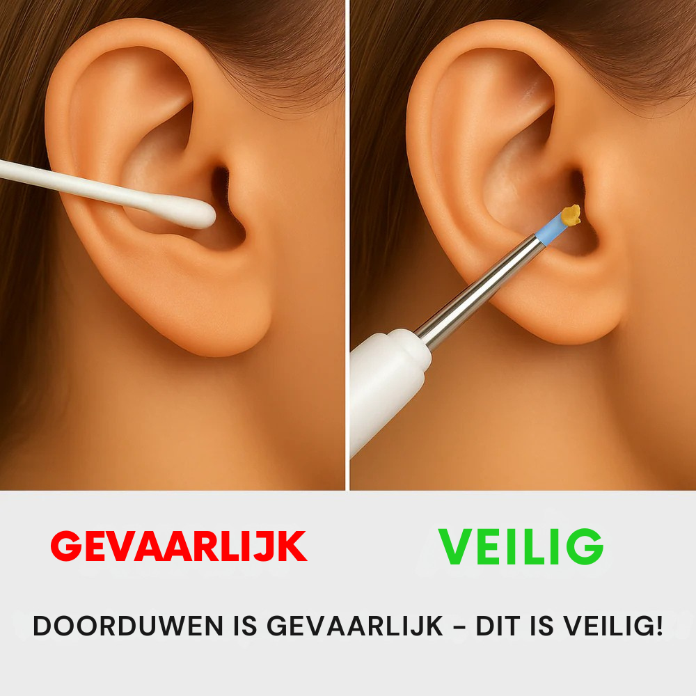 OorZicht® Pro｜Professionele Oorenreiniger